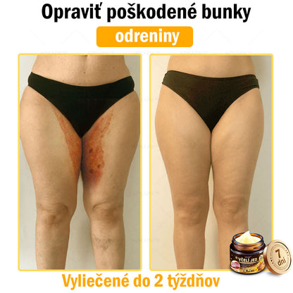 Zostalo už len 5 plechoviek! Ponúkame 50 % extra zľavu! Udržujte svoju pleť zdravú. Ak to teraz zmeškáte, budete mať šancu až budúci rok!