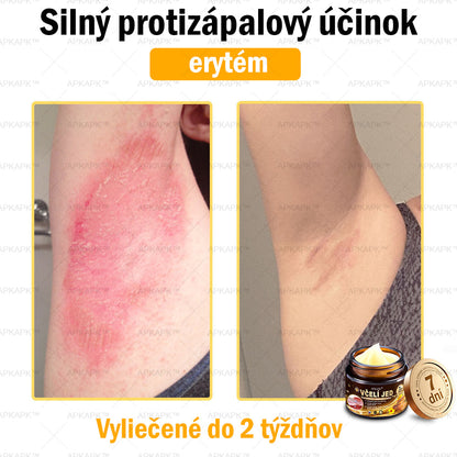 Zostalo už len 5 plechoviek! Ponúkame 50 % extra zľavu! Udržujte svoju pleť zdravú. Ak to teraz zmeškáte, budete mať šancu až budúci rok!