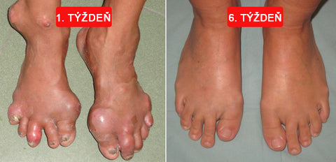 🎁🎁🌿 𝐔ž 𝐥𝐞𝐧 𝟓 𝐛𝐚𝐥𝐞𝐧í 𝐳𝐨𝐬𝐭𝐚𝐥𝐨! 𝐏𝐨𝐬𝐤𝐲𝐭𝐮𝐣𝐞𝐦𝐞 ď𝐚𝐥ší𝐜𝐡 𝟓𝟎% 𝐳ľ𝐚𝐯𝐮! 𝐙𝐝𝐫𝐚𝐯š𝐢𝐞 𝐭𝐞𝐥𝐨 𝐣𝐞 𝐧𝐚 𝐝𝐨𝐬𝐚𝐡! 𝐀𝐤 𝐭𝐞𝐫𝐚𝐳 𝐳𝐦𝐞š𝐤áš, 𝐝𝐨𝐬𝐭𝐚𝐧𝐞š 𝐭𝐨 𝐚ž 𝐛𝐮𝐝ú𝐜𝐢 𝐫𝐨𝐤.