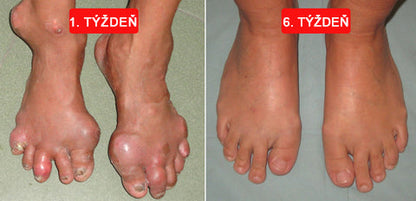 🎁🎁🌿 𝐔ž 𝐥𝐞𝐧 𝟓 𝐛𝐚𝐥𝐞𝐧í 𝐳𝐨𝐬𝐭𝐚𝐥𝐨! 𝐏𝐨𝐬𝐤𝐲𝐭𝐮𝐣𝐞𝐦𝐞 ď𝐚𝐥ší𝐜𝐡 𝟓𝟎% 𝐳ľ𝐚𝐯𝐮! 𝐙𝐝𝐫𝐚𝐯š𝐢𝐞 𝐭𝐞𝐥𝐨 𝐣𝐞 𝐧𝐚 𝐝𝐨𝐬𝐚𝐡! 𝐀𝐤 𝐭𝐞𝐫𝐚𝐳 𝐳𝐦𝐞š𝐤áš, 𝐝𝐨𝐬𝐭𝐚𝐧𝐞š 𝐭𝐨 𝐚ž 𝐛𝐮𝐝ú𝐜𝐢 𝐫𝐨𝐤.