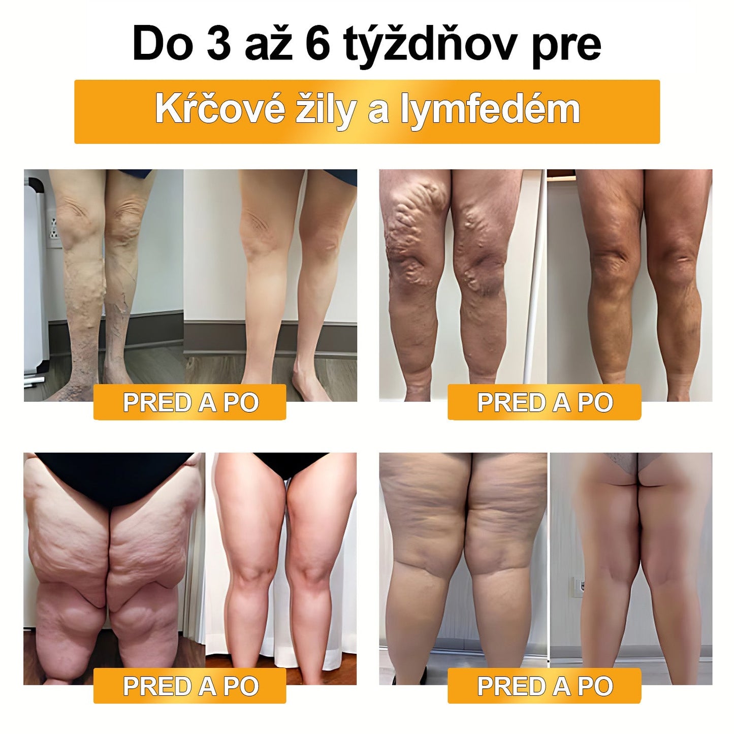 🍯👑🍯𝐅𝐞𝐧𝐮𝐫𝐞𝐞™ 𝐎𝐛𝐦𝐞𝐝𝐳𝐞𝐧á 𝐝𝐨𝐛𝐚 𝟕𝟎% 𝐙Ľ𝐀𝐕𝐀 - [𝐕𝐲𝐯𝐢𝐧𝐮𝐭é 𝐯 𝐊𝐚𝐥𝐢𝐟𝐨𝐫𝐧𝐢𝐢, 𝐔𝐒𝐀] 🔥❤️ 𝐕č𝐞𝐥í 𝐉𝐞𝐝 𝐋𝐲𝐦𝐟𝐚𝐭𝐢𝐜𝐤á 𝐃𝐫𝐞𝐧áž𝐧𝐚 𝐙𝐨š𝐭í𝐡ľ𝐮𝐣ú𝐜𝐚 𝐍á𝐩𝐥𝐚𝐬ť (𝐕𝐡𝐨𝐝𝐧é 𝐍𝐚 𝐏𝐨𝐮ž𝐢𝐭𝐢𝐞 𝐏𝐫𝐞 𝐉𝐞𝐝𝐧𝐨𝐭𝐥𝐢𝐯𝐜𝐨𝐯 𝐕š𝐞𝐭𝐤ý𝐜𝐡 𝐕𝐞𝐤𝐨𝐯ý𝐜𝐡 𝐊𝐚𝐭𝐞𝐠ó𝐫𝐢í)