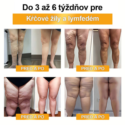 🍯👑🍯𝐅𝐞𝐧𝐮𝐫𝐞𝐞™ 𝐎𝐛𝐦𝐞𝐝𝐳𝐞𝐧á 𝐝𝐨𝐛𝐚 𝟕𝟎% 𝐙Ľ𝐀𝐕𝐀 - [𝐕𝐲𝐯𝐢𝐧𝐮𝐭é 𝐯 𝐊𝐚𝐥𝐢𝐟𝐨𝐫𝐧𝐢𝐢, 𝐔𝐒𝐀] 🔥❤️ 𝐕č𝐞𝐥í 𝐉𝐞𝐝 𝐋𝐲𝐦𝐟𝐚𝐭𝐢𝐜𝐤á 𝐃𝐫𝐞𝐧áž𝐧𝐚 𝐙𝐨š𝐭í𝐡ľ𝐮𝐣ú𝐜𝐚 𝐍á𝐩𝐥𝐚𝐬ť (𝐕𝐡𝐨𝐝𝐧é 𝐍𝐚 𝐏𝐨𝐮ž𝐢𝐭𝐢𝐞 𝐏𝐫𝐞 𝐉𝐞𝐝𝐧𝐨𝐭𝐥𝐢𝐯𝐜𝐨𝐯 𝐕š𝐞𝐭𝐤ý𝐜𝐡 𝐕𝐞𝐤𝐨𝐯ý𝐜𝐡 𝐊𝐚𝐭𝐞𝐠ó𝐫𝐢í)