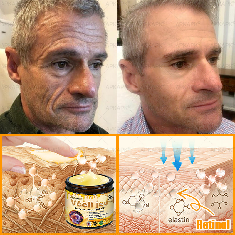 Vyrobené a odoslané zo Slovenska ✨✨𝖠𝖯𝖪𝖠𝖯𝖪® 𝖡𝖾𝖾 𝗏𝖾𝗇𝗈𝗆 𝖪𝗋𝖾𝗆 𝗇𝖺 𝗈𝗉𝗋𝖺𝗏𝗎 𝗉𝗅𝖾𝗍𝗂