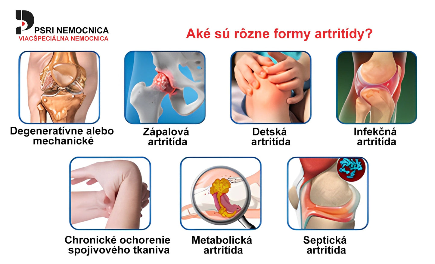 🎁🎁🌿 𝐔ž 𝐥𝐞𝐧 𝟓 𝐛𝐚𝐥𝐞𝐧í 𝐳𝐨𝐬𝐭𝐚𝐥𝐨! 𝐏𝐨𝐬𝐤𝐲𝐭𝐮𝐣𝐞𝐦𝐞 ď𝐚𝐥ší𝐜𝐡 𝟓𝟎% 𝐳ľ𝐚𝐯𝐮! 𝐙𝐝𝐫𝐚𝐯š𝐢𝐞 𝐭𝐞𝐥𝐨 𝐣𝐞 𝐧𝐚 𝐝𝐨𝐬𝐚𝐡! 𝐀𝐤 𝐭𝐞𝐫𝐚𝐳 𝐳𝐦𝐞š𝐤áš, 𝐝𝐨𝐬𝐭𝐚𝐧𝐞š 𝐭𝐨 𝐚ž 𝐛𝐮𝐝ú𝐜𝐢 𝐫𝐨𝐤.