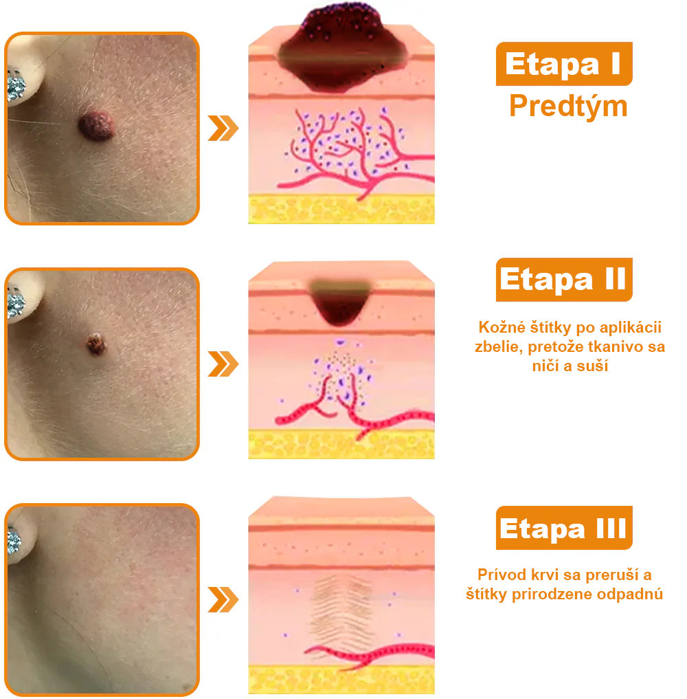 🎁𝐁𝐞𝐚𝐫𝐧𝐢𝐜𝐚™ 𝐔ž 𝐥𝐞𝐧 𝟓 𝐛𝐚𝐥𝐞𝐧í! 𝐏𝐨𝐧ú𝐤𝐚𝐦𝐞 𝐝𝐨𝐝𝐚𝐭𝐨č𝐧ú 𝐳ľ𝐚𝐯𝐮 𝟓𝟎%!