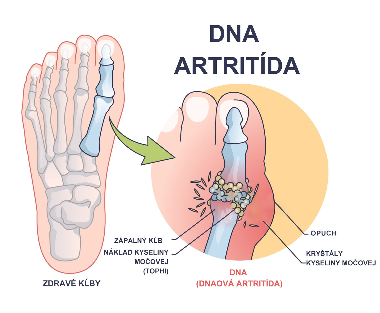 🎁🎁🌿 𝐔ž 𝐥𝐞𝐧 𝟓 𝐛𝐚𝐥𝐞𝐧í 𝐳𝐨𝐬𝐭𝐚𝐥𝐨! 𝐏𝐨𝐬𝐤𝐲𝐭𝐮𝐣𝐞𝐦𝐞 ď𝐚𝐥ší𝐜𝐡 𝟓𝟎% 𝐳ľ𝐚𝐯𝐮! 𝐙𝐝𝐫𝐚𝐯š𝐢𝐞 𝐭𝐞𝐥𝐨 𝐣𝐞 𝐧𝐚 𝐝𝐨𝐬𝐚𝐡! 𝐀𝐤 𝐭𝐞𝐫𝐚𝐳 𝐳𝐦𝐞š𝐤áš, 𝐝𝐨𝐬𝐭𝐚𝐧𝐞š 𝐭𝐨 𝐚ž 𝐛𝐮𝐝ú𝐜𝐢 𝐫𝐨𝐤.