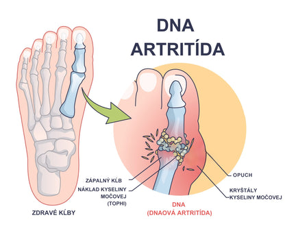 🎁🎁🌿 𝐔ž 𝐥𝐞𝐧 𝟓 𝐛𝐚𝐥𝐞𝐧í 𝐳𝐨𝐬𝐭𝐚𝐥𝐨! 𝐏𝐨𝐬𝐤𝐲𝐭𝐮𝐣𝐞𝐦𝐞 ď𝐚𝐥ší𝐜𝐡 𝟓𝟎% 𝐳ľ𝐚𝐯𝐮! 𝐙𝐝𝐫𝐚𝐯š𝐢𝐞 𝐭𝐞𝐥𝐨 𝐣𝐞 𝐧𝐚 𝐝𝐨𝐬𝐚𝐡! 𝐀𝐤 𝐭𝐞𝐫𝐚𝐳 𝐳𝐦𝐞š𝐤áš, 𝐝𝐨𝐬𝐭𝐚𝐧𝐞š 𝐭𝐨 𝐚ž 𝐛𝐮𝐝ú𝐜𝐢 𝐫𝐨𝐤.