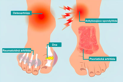 🎁🎁🌿 𝐔ž 𝐥𝐞𝐧 𝟓 𝐛𝐚𝐥𝐞𝐧í 𝐳𝐨𝐬𝐭𝐚𝐥𝐨! 𝐏𝐨𝐬𝐤𝐲𝐭𝐮𝐣𝐞𝐦𝐞 ď𝐚𝐥ší𝐜𝐡 𝟓𝟎% 𝐳ľ𝐚𝐯𝐮! 𝐙𝐝𝐫𝐚𝐯š𝐢𝐞 𝐭𝐞𝐥𝐨 𝐣𝐞 𝐧𝐚 𝐝𝐨𝐬𝐚𝐡! 𝐀𝐤 𝐭𝐞𝐫𝐚𝐳 𝐳𝐦𝐞š𝐤áš, 𝐝𝐨𝐬𝐭𝐚𝐧𝐞š 𝐭𝐨 𝐚ž 𝐛𝐮𝐝ú𝐜𝐢 𝐫𝐨𝐤.