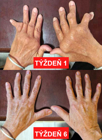 🎁🎁🌿 𝐔ž 𝐥𝐞𝐧 𝟓 𝐛𝐚𝐥𝐞𝐧í 𝐳𝐨𝐬𝐭𝐚𝐥𝐨! 𝐏𝐨𝐬𝐤𝐲𝐭𝐮𝐣𝐞𝐦𝐞 ď𝐚𝐥ší𝐜𝐡 𝟓𝟎% 𝐳ľ𝐚𝐯𝐮! 𝐙𝐝𝐫𝐚𝐯š𝐢𝐞 𝐭𝐞𝐥𝐨 𝐣𝐞 𝐧𝐚 𝐝𝐨𝐬𝐚𝐡! 𝐀𝐤 𝐭𝐞𝐫𝐚𝐳 𝐳𝐦𝐞š𝐤áš, 𝐝𝐨𝐬𝐭𝐚𝐧𝐞š 𝐭𝐨 𝐚ž 𝐛𝐮𝐝ú𝐜𝐢 𝐫𝐨𝐤.