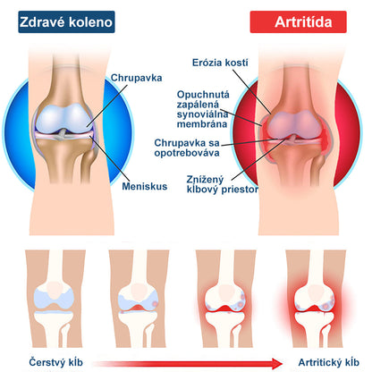 🎁🎁🌿 𝐔ž 𝐥𝐞𝐧 𝟓 𝐛𝐚𝐥𝐞𝐧í 𝐳𝐨𝐬𝐭𝐚𝐥𝐨! 𝐏𝐨𝐬𝐤𝐲𝐭𝐮𝐣𝐞𝐦𝐞 ď𝐚𝐥ší𝐜𝐡 𝟓𝟎% 𝐳ľ𝐚𝐯𝐮! 𝐙𝐝𝐫𝐚𝐯š𝐢𝐞 𝐭𝐞𝐥𝐨 𝐣𝐞 𝐧𝐚 𝐝𝐨𝐬𝐚𝐡! 𝐀𝐤 𝐭𝐞𝐫𝐚𝐳 𝐳𝐦𝐞š𝐤áš, 𝐝𝐨𝐬𝐭𝐚𝐧𝐞š 𝐭𝐨 𝐚ž 𝐛𝐮𝐝ú𝐜𝐢 𝐫𝐨𝐤.