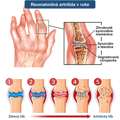 🎁🎁🌿 𝐔ž 𝐥𝐞𝐧 𝟓 𝐛𝐚𝐥𝐞𝐧í 𝐳𝐨𝐬𝐭𝐚𝐥𝐨! 𝐏𝐨𝐬𝐤𝐲𝐭𝐮𝐣𝐞𝐦𝐞 ď𝐚𝐥ší𝐜𝐡 𝟓𝟎% 𝐳ľ𝐚𝐯𝐮! 𝐙𝐝𝐫𝐚𝐯š𝐢𝐞 𝐭𝐞𝐥𝐨 𝐣𝐞 𝐧𝐚 𝐝𝐨𝐬𝐚𝐡! 𝐀𝐤 𝐭𝐞𝐫𝐚𝐳 𝐳𝐦𝐞š𝐤áš, 𝐝𝐨𝐬𝐭𝐚𝐧𝐞š 𝐭𝐨 𝐚ž 𝐛𝐮𝐝ú𝐜𝐢 𝐫𝐨𝐤.