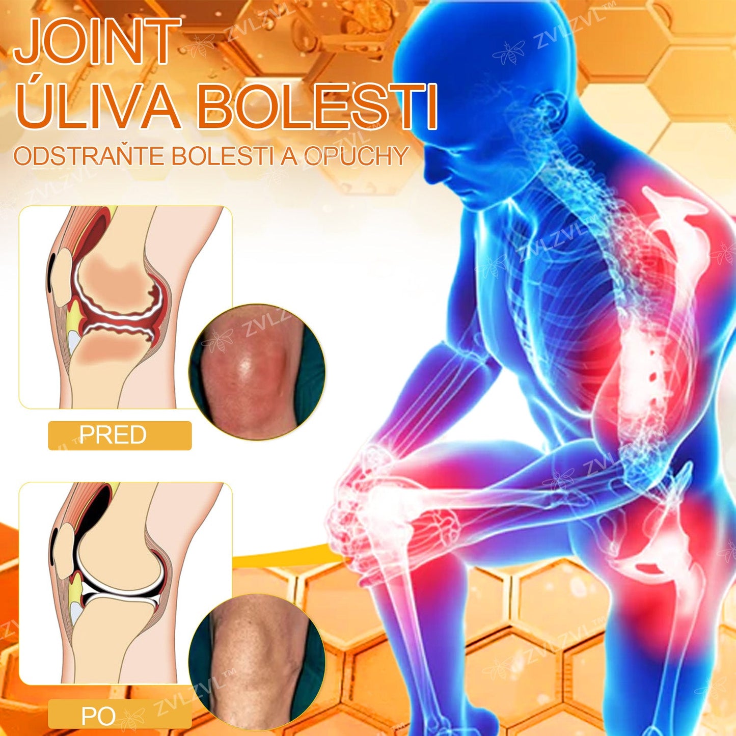 ✅ Oficiálny obchod: ZVLZVL™ Krém na zmiernenie bolesti a obnovenie kostí s včelím jedom &👨‍⚕️ Zdravotná certifikácia Slovensko (znižuje opuchy kĺbov, bolesť, stuhnutosť, začervenanie, teplo, bolesť a únavu kĺbov)