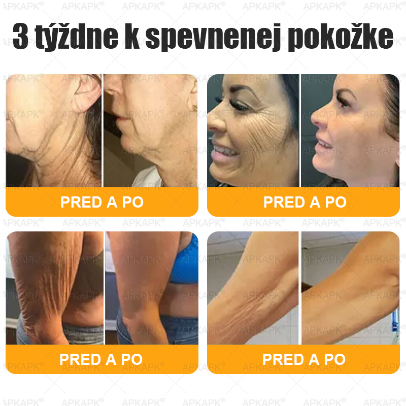 Vyrobené a odoslané zo Slovenska ✨✨𝖠𝖯𝖪𝖠𝖯𝖪® 𝖡𝖾𝖾 𝗏𝖾𝗇𝗈𝗆 𝖪𝗋𝖾𝗆 𝗇𝖺 𝗈𝗉𝗋𝖺𝗏𝗎 𝗉𝗅𝖾𝗍𝗂