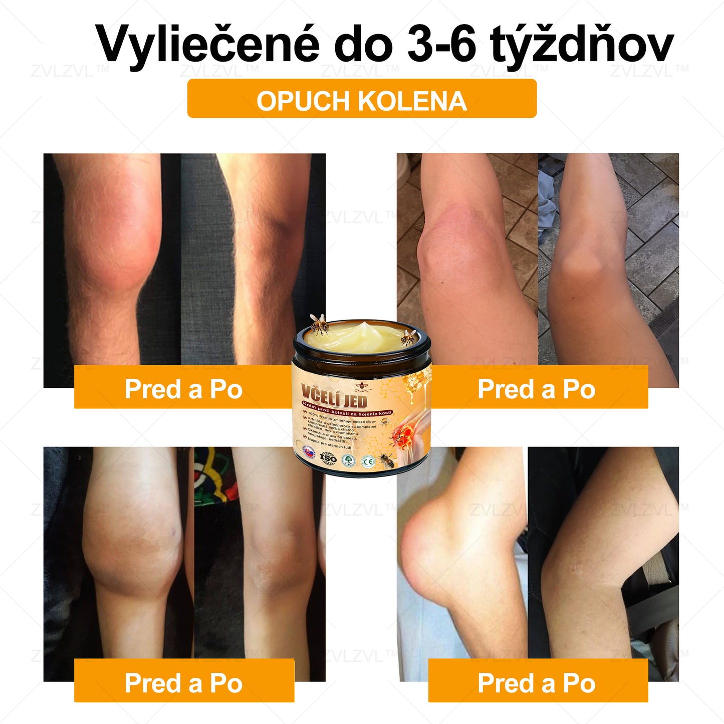 ✅ Oficiálny obchod: ZVLZVL™ Krém na zmiernenie bolesti a obnovenie kostí s včelím jedom &👨‍⚕️ Zdravotná certifikácia Slovensko (znižuje opuchy kĺbov, bolesť, stuhnutosť, začervenanie, teplo, bolesť a únavu kĺbov)