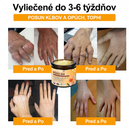 ✅ Oficiálny obchod: ZVLZVL™ Krém na zmiernenie bolesti a obnovenie kostí s včelím jedom &👨‍⚕️ Zdravotná certifikácia Slovensko (znižuje opuchy kĺbov, bolesť, stuhnutosť, začervenanie, teplo, bolesť a únavu kĺbov)