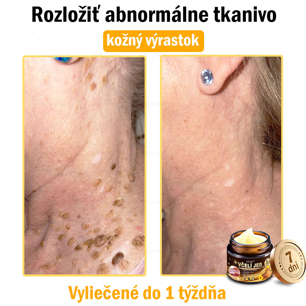 Zostalo už len 5 plechoviek! Ponúkame 50 % extra zľavu! Udržujte svoju pleť zdravú. Ak to teraz zmeškáte, budete mať šancu až budúci rok!