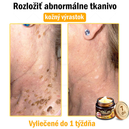 Zostalo už len 5 plechoviek! Ponúkame 50 % extra zľavu! Udržujte svoju pleť zdravú. Ak to teraz zmeškáte, budete mať šancu až budúci rok!