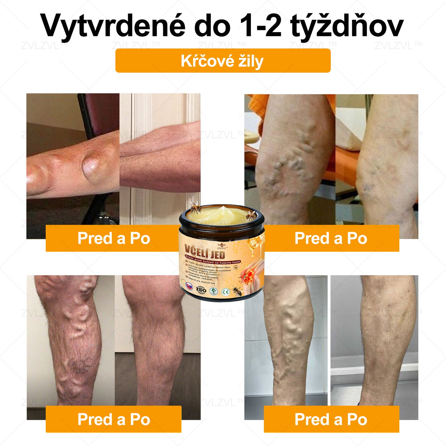 ✅ Oficiálny obchod: ZVLZVL™ Krém na zmiernenie bolesti a obnovenie kostí s včelím jedom &👨‍⚕️ Zdravotná certifikácia Slovensko (znižuje opuchy kĺbov, bolesť, stuhnutosť, začervenanie, teplo, bolesť a únavu kĺbov)