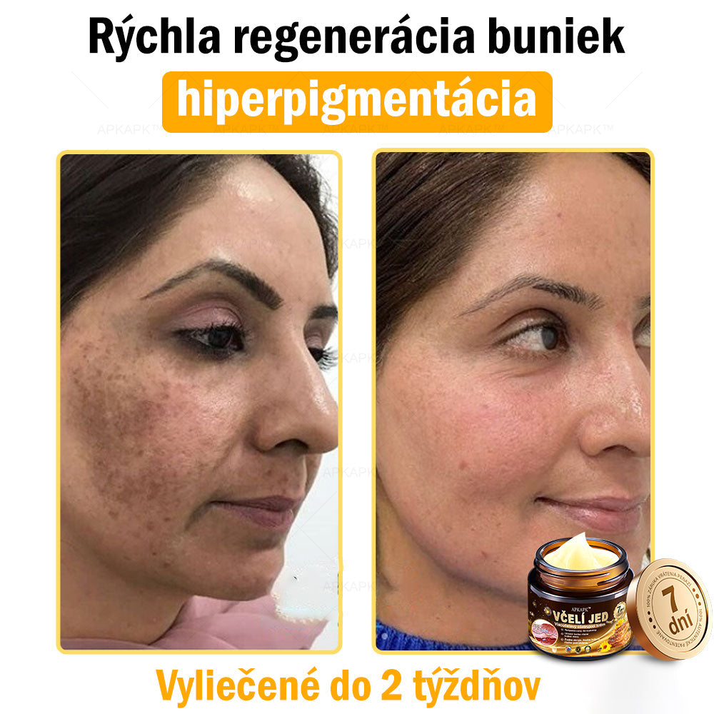 Zostalo už len 5 plechoviek! Ponúkame 50 % extra zľavu! Udržujte svoju pleť zdravú. Ak to teraz zmeškáte, budete mať šancu až budúci rok!