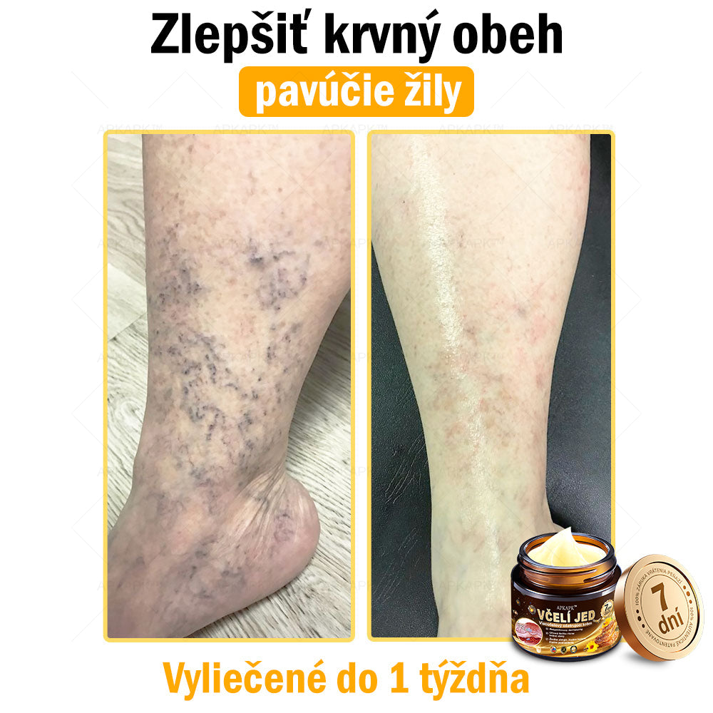 Zostalo už len 5 plechoviek! Ponúkame 50 % extra zľavu! Udržujte svoju pleť zdravú. Ak to teraz zmeškáte, budete mať šancu až budúci rok!